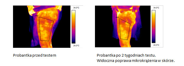 Lirene Walcz z Cellulitem Sekret Urody